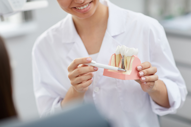 dentist explaining tooth implantation process W4PZYA8