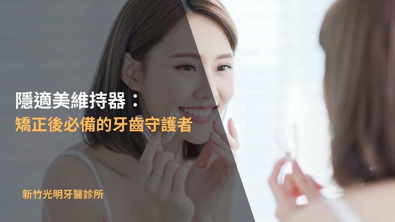 Read more about the article 隱適美維持器：矯正後必備的牙齒守護者